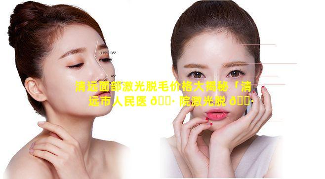 清远面部激光脱毛价格大揭秘「清远市人民医 🕷 院激光脱 🕷 毛」